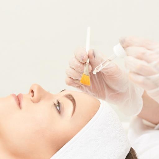 Chemical Peels